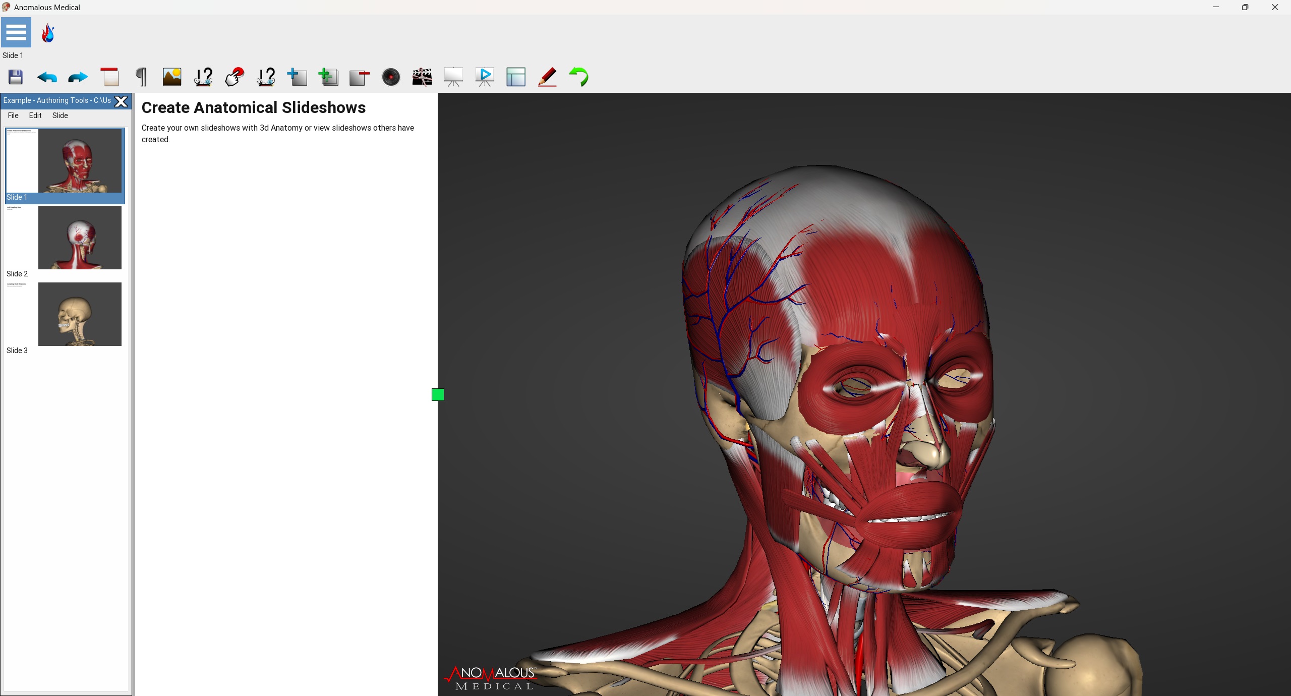 A screenshot of Anomalous Medical featuring the skull anatomy.